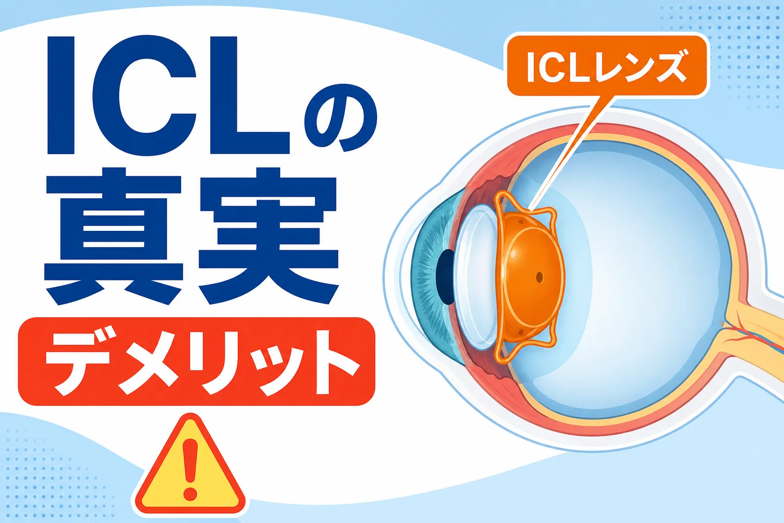 icl デメリット リスク｜ICLのデメリットとリスクを解説するアイキャッチ画像
